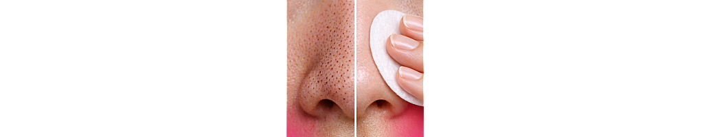 Blackhead remover Blackhead remover