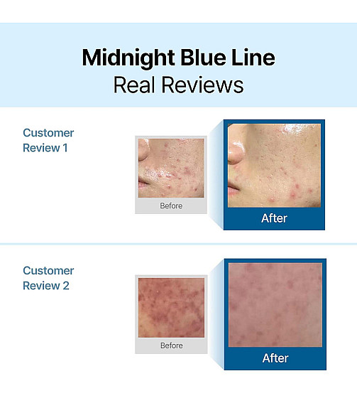 Dear, Klairs Midnight Blue Calming Cream (60ml)