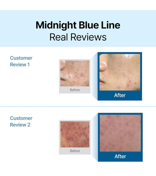 Dear, Klairs Midnight Blue Calming Cream (60ml)