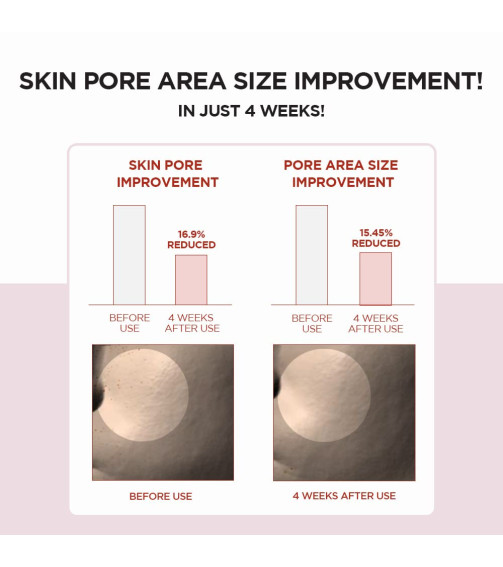 SKIN1004 Madagascar Centella Poremizing Fresh Ampoule 100ml