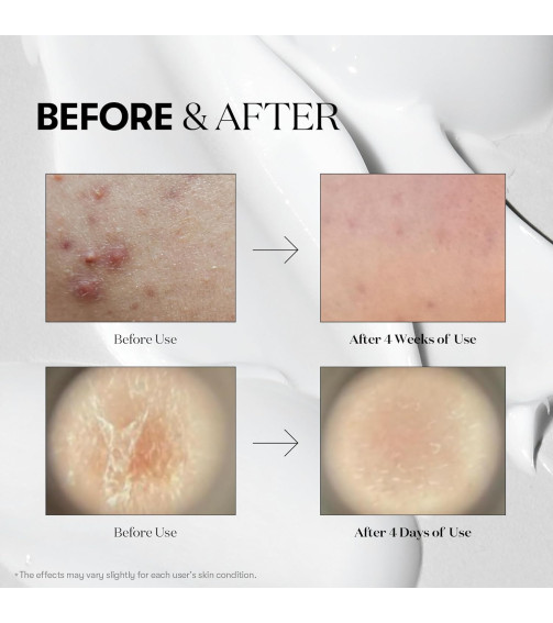 VT COSMETICS CICA Reedle Shot 100 Essence